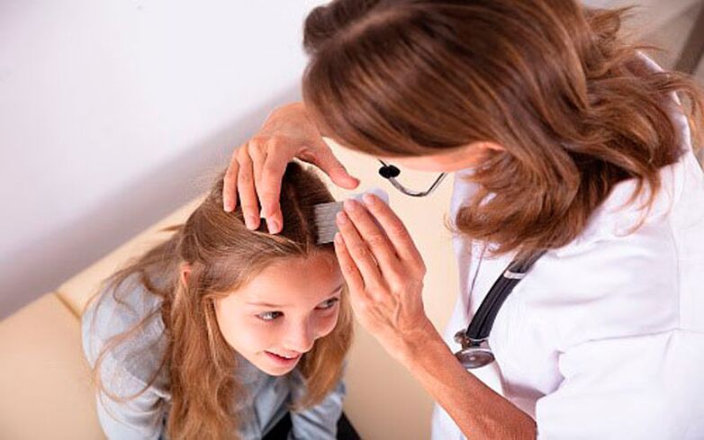 çocuklarda kafa sedef hastalığı tedavisi