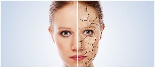 Sedef hastalığını tedavi ediyoruz